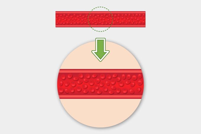 혈액이 동맥으로 지나가는 모습